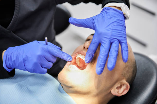 Best Emergency Dental Care for Broken or Chipped Teeth in Wellington, OH
